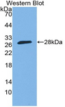 SP140 Antibody - Western blot of recombinant SP140.