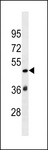 SP140L Antibody - SP140L Antibody western blot of CEM cell line lysates (35 ug/lane). The SP140L Antibody detected the SP140L protein (arrow).