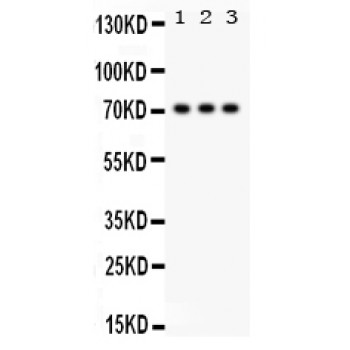 SP2 Antibody - SP2 antibody Western blot. All lanes: Anti SP2 at 0.5 ug/ml. Lane 1: Rat Lung Tissue Lysate at 50 ug. Lane 2: A549 Whole Cell Lysate at 40 ug. Lane 3: HELA Whole Cell Lysate at 40 ug. Predicted band size: 72 kD. Observed band size: 72 kD.