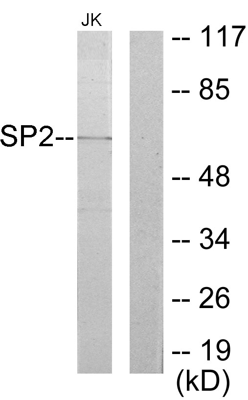 SP2 Antibody - Western blot analysis of lysates from Jurkat cells, using SP2 Antibody. The lane on the right is blocked with the synthesized peptide.