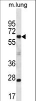 SP2 Antibody - SP2 Antibody western blot of mouse lung tissue lysates (35 ug/lane). The SP2 antibody detected the SP2 protein (arrow).