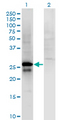 SP2 Antibody - Western Blot analysis of SP2 expression in transfected 293T cell line by SP2 monoclonal antibody (M01), clone 5D3.Lane 1: SP2 transfected lysate (Predicted MW: 25.6 KDa).Lane 2: Non-transfected lysate.