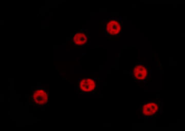 SP2 Antibody - Staining HepG2 cells by IF/ICC. The samples were fixed with PFA and permeabilized in 0.1% Triton X-100, then blocked in 10% serum for 45 min at 25°C. The primary antibody was diluted at 1:200 and incubated with the sample for 1 hour at 37°C. An Alexa Fluor 594 conjugated goat anti-rabbit IgG (H+L) Ab, diluted at 1/600, was used as the secondary antibody.