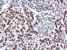 SP3 Antibody - Anti-SP3 antibody used in IHC (Formalin-fixed paraffin-embedded sections).
