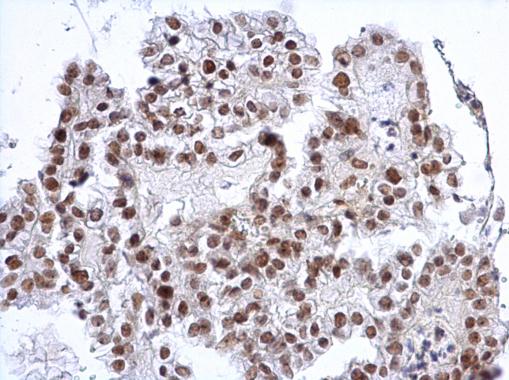 SP3 Antibody - Anti-SP3 antibody used in IHC (Formalin-fixed paraffin-embedded sections).