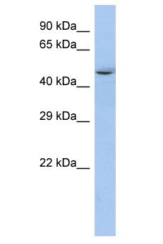 SP3 Antibody - SP3 antibody Western Blot of RPMI-8226. Antibody dilution: 1 ug/ml.  This image was taken for the unconjugated form of this product. Other forms have not been tested.