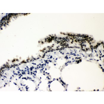 SP3 Antibody - SP3 antibody IHC-paraffin. IHC(P): Rat Lung Tissue.