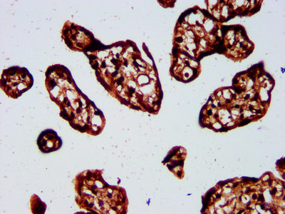 SP3 Antibody - Immunohistochemistry Dilution at 1:500 and staining in paraffin-embedded human placenta tissue performed on a Leica BondTM system. After dewaxing and hydration, antigen retrieval was mediated by high pressure in a citrate buffer (pH 6.0). Section was blocked with 10% normal Goat serum 30min at RT. Then primary antibody (1% BSA) was incubated at 4°C overnight. The primary is detected by a biotinylated Secondary antibody and visualized using an HRP conjugated SP system.