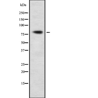 SP3 Antibody - Western blot analysis Sp3/4 using Jurkat whole cells lysates