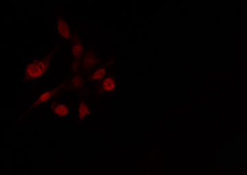 SP3 Antibody - Staining HeLa cells by IF/ICC. The samples were fixed with PFA and permeabilized in 0.1% Triton X-100, then blocked in 10% serum for 45 min at 25°C. The primary antibody was diluted at 1:200 and incubated with the sample for 1 hour at 37°C. An Alexa Fluor 594 conjugated goat anti-rabbit IgG (H+L) Ab, diluted at 1/600, was used as the secondary antibody.