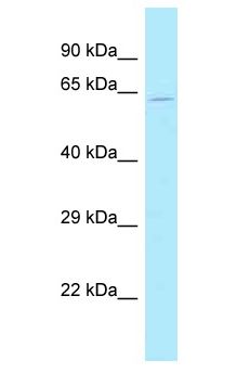 SP32 / ACRBP Antibody - SP32 / ACRBP antibody Western Blot of HeLa. Antibody dilution: 1 ug/ml.  This image was taken for the unconjugated form of this product. Other forms have not been tested.