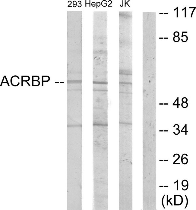 SP32 / ACRBP Antibody - Western blot analysis of lysates from HepG2, Jurkat, and 293 cells, using ACRBP Antibody. The lane on the right is blocked with the synthesized peptide.