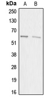 SP32 / ACRBP Antibody - Western blot analysis of ACRBP expression in HEK293T (A); HeLa (B) whole cell lysates.