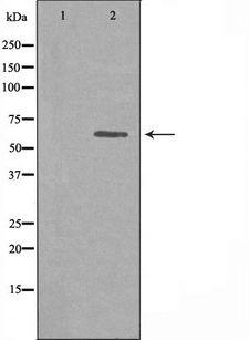 SP32 / ACRBP Antibody - Western blot analysis of extracts of 293 cells using ACRBP antibody. The lane on the left is treated with the antigen-specific peptide.