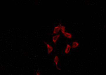 SP32 / ACRBP Antibody - Staining HepG2 cells by IF/ICC. The samples were fixed with PFA and permeabilized in 0.1% Triton X-100, then blocked in 10% serum for 45 min at 25°C. The primary antibody was diluted at 1:200 and incubated with the sample for 1 hour at 37°C. An Alexa Fluor 594 conjugated goat anti-rabbit IgG (H+L) Ab, diluted at 1/600, was used as the secondary antibody.