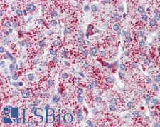 SP4 Antibody - Anti-SP4 antibody IHC of human liver. Immunohistochemistry of formalin-fixed, paraffin-embedded tissue after heat-induced antigen retrieval. Antibody concentration 5 ug/ml.  This image was taken for the unconjugated form of this product. Other forms have not been tested.