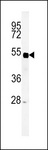 SP5 Antibody - Western blot of SP5 Antibody in mouse liver tissue lysates (35 ug/lane). SP5 (arrow) was detected using the purified antibody.