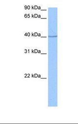 SP6 Transcription Factor Antibody - Jurkat cell lysate. Antibody concentration: 0.5 ug/ml. Gel concentration: 12%.  This image was taken for the unconjugated form of this product. Other forms have not been tested.