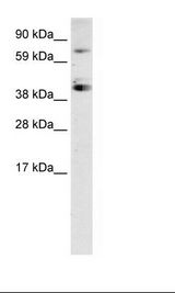 SP7 / Osterix Antibody - Fetal Kidney Lysate.  This image was taken for the unconjugated form of this product. Other forms have not been tested.
