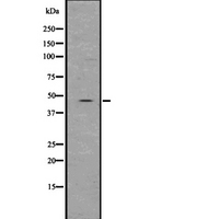 SP7 / Osterix Antibody - Western blot analysis of Osterix using K562 whole lysates.