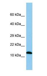 SPA17 / Sperm Protein 17 Antibody - SPA17 / Sperm Protein 17 antibody Western Blot of Rat Small Intestine.  This image was taken for the unconjugated form of this product. Other forms have not been tested.