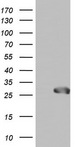 SPA17 / Sperm Protein 17 Antibody - HEK293T cells were transfected with the pCMV6-ENTRY control. (Left lane) or pCMV6-ENTRY SPA17. (Right lane) cDNA for 48 hrs and lysed. Equivalent amounts of cell lysates. (5 ug per lane) were separated by SDS-PAGE and immunoblotted with anti-SPA17.