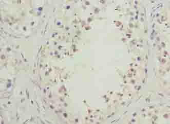 SPACA1 Antibody - Immunohistochemistry of paraffin-embedded human testis tissue using antibody at dilution of 1:100.
