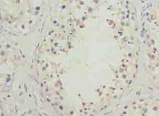 SPACA1 Antibody - Immunohistochemistry of paraffin-embedded human testis tissue using antibody at dilution of 1:100.