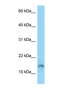 SPACA4 / SAMP14 Antibody - SPACA4 antibody Western blot of Jurkat Cell lysate. Antibody concentration 1 ug/ml.  This image was taken for the unconjugated form of this product. Other forms have not been tested.