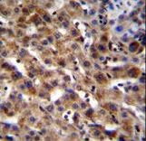 SPACA5 Antibody - SPACA5B Antibody immunohistochemistry of formalin-fixed and paraffin-embedded human liver tissue followed by peroxidase-conjugated secondary antibody and DAB staining.