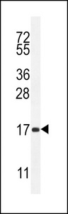 SPACA5 Antibody - SPACA5 Antibody western blot of mouse heart tissue lysates (35 ug/lane). The SPACA5 antibody detected the SPACA5 protein (arrow).