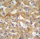 SPACA5 Antibody - SPACA5 Antibody immunohistochemistry of formalin-fixed and paraffin-embedded human liver tissue followed by peroxidase-conjugated secondary antibody and DAB staining.