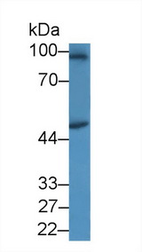 SPAG1 / TPIS Antibody - Western Blot; Sample: Human Jurkat cell lysate; Primary Ab: 1µg/ml Rabbit Anti-Human SPAG1 Antibody Second Ab: 0.2µg/mL HRP-Linked Caprine Anti-Rabbit IgG Polyclonal Antibody