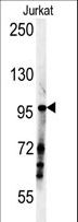 SPAG1 / TPIS Antibody - SPAG1 Antibody western blot of Jurkat cell line lysates (35 ug/lane). The SPAG1 antibody detected the SPAG1 protein (arrow).