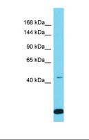 SPAG1 / TPIS Antibody - Western blot of Human MCF7. SPAG1 antibody dilution 1.0 ug/ml.  This image was taken for the unconjugated form of this product. Other forms have not been tested.