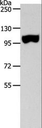 SPAG1 / TPIS Antibody - Western blot analysis of Human colon tissue, using SPAG1 Polyclonal Antibody at dilution of 1:600.