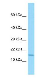 SPAG11A Antibody - SPAG11A antibody Western Blot of HCT15.  This image was taken for the unconjugated form of this product. Other forms have not been tested.