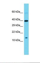 SPAG11B Antibody - Western blot of Human Large Intestine Tumor. SPAG11B antibody dilution 1.0 ug/ml.  This image was taken for the unconjugated form of this product. Other forms have not been tested.