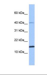 SPAG11B Antibody - Fetal muscle lysate. Antibody concentration: 1.0 ug/ml. Gel concentration: 10-20%.  This image was taken for the unconjugated form of this product. Other forms have not been tested.