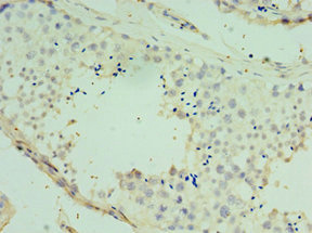 SPAG16 Antibody - Immunohistochemistry of paraffin-embedded human testis tissue using SPAG16 Antibody at dilution of 1:100