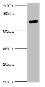 SPAG16 Antibody - Western blot All lanes: SPAG16 antibody at 6µg/ml + Mouse brain tissue Secondary Goat polyclonal to rabbit IgG at 1/10000 dilution Predicted band size: 71, 51, 30, 21, 40 kDa Observed band size: 71 kDa