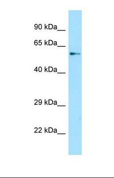 SPAG16 Antibody - Western blot of Human HepG2. SPAG16 antibody dilution 1.0 ug/ml.  This image was taken for the unconjugated form of this product. Other forms have not been tested.