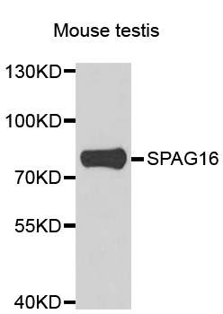 SPAG16 Antibody - Western blot analysis of extracts of mouse testis.