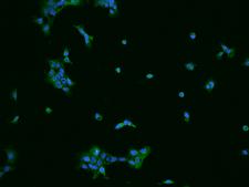 SPAG16 Antibody - Immunofluorescence staining of SPAG16 in A431 cells. Cells were fixed with 4% PFA, permeabilzed with 0.1% Triton X-100 in PBS, blocked with 10% serum, and incubated with rabbit anti-Human SPAG16 polyclonal antibody (dilution ratio 1:1000) at 4°C overnight. Then cells were stained with the Alexa Fluor 488-conjugated Goat Anti-rabbit IgG secondary antibody (green) and counterstained with DAPI (blue). Positive staining was localized to Cytoplasm.