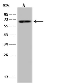 SPAG16 Antibody - Anti-SPAG16 rabbit polyclonal antibody at 1:500 dilution. Lane A: HepG2 Whole Cell Lysate. Lysates/proteins at 30 ug per lane. Secondary: Goat Anti-Rabbit IgG (H+L)/HRP at 1/10000 dilution. Developed using the ECL technique. Performed under reducing conditions. Predicted band size: 70 kDa. Observed band size: 70 kDa.