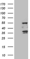 SPAG4 Antibody - HEK293T cells were transfected with the pCMV6-ENTRY control. (Left lane) or pCMV6-ENTRY SPAG4. (Right lane) cDNA for 48 hrs and lysed. Equivalent amounts of cell lysates. (5 ug per lane) were separated by SDS-PAGE and immunoblotted with anti-SPAG4. (1:500)