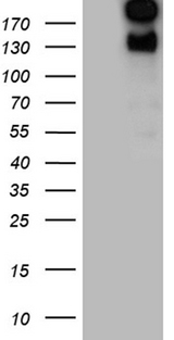 SPAG5 / MAP126 Antibody - HEK293T cells were transfected with the pCMV6-ENTRY control. (Left lane) or pCMV6-ENTRY SPAG5. (Right lane) cDNA for 48 hrs and lysed