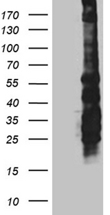 SPAG5 / MAP126 Antibody - HEK293T cells were transfected with the pCMV6-ENTRY control. (Left lane) or pCMV6-ENTRY SPAG5. (Right lane) cDNA for 48 hrs and lysed. Equivalent amounts of cell lysates. (5 ug per lane) were separated by SDS-PAGE and immunoblotted with anti-SPAG5. (1:2000)