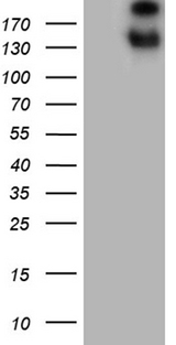 SPAG5 / MAP126 Antibody - HEK293T cells were transfected with the pCMV6-ENTRY control. (Left lane) or pCMV6-ENTRY SPAG5. (Right lane) cDNA for 48 hrs and lysed