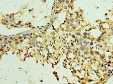 SPAG5 / MAP126 Antibody - Immunohistochemistry of paraffin-embedded human testis using antibody at 1:100 dilution.